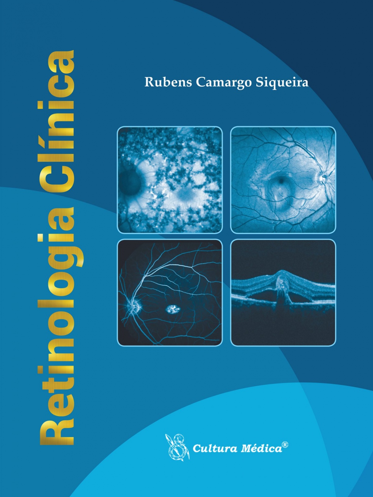 Retinologia Clínica