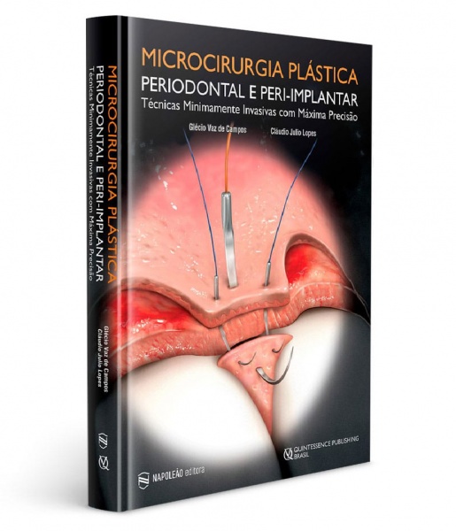 Microcirurgia Plástica Periodontal E Peri-Implantar