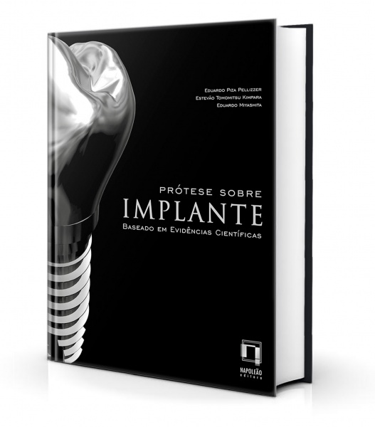 Prótese Sobre Implante – Baseado Em Evidências Científicas