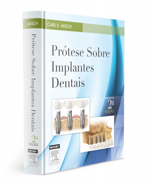 Prótese Sobre Implantes Dentais