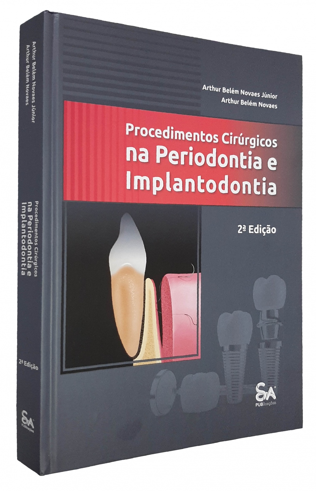 Procedimentos Cirúrgicos Na Periodontia E Implantodontia