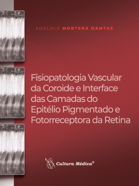 Fisiopatologia Vascular Da Coroide E Interface Das Camadas Do Epitélio Pigmentado E Fotorreceptora Da Retina