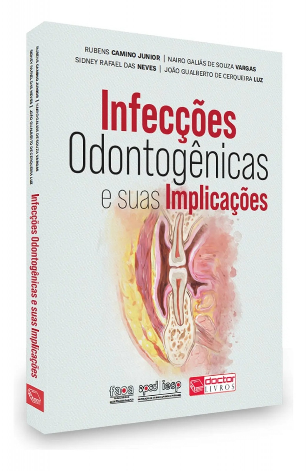 Infecções Odontogênicas E Suas Implicações