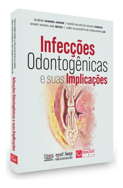 Infecções Odontogênicas E Suas Implicações
