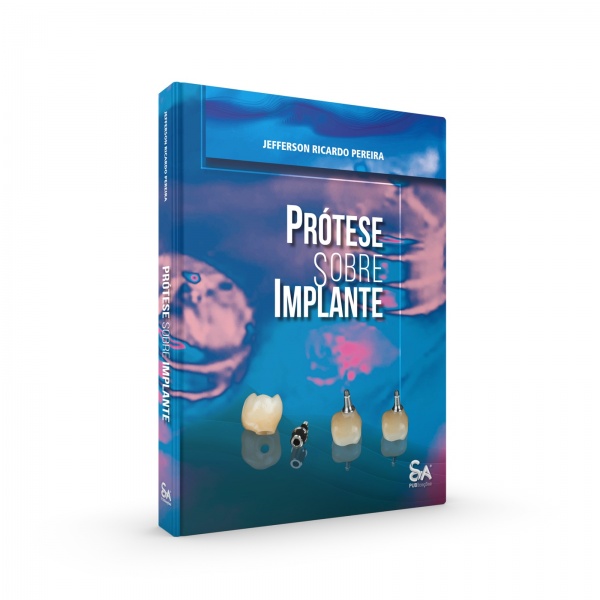 Prótese Sobre Implante