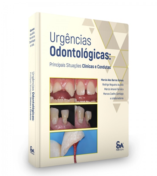 Urgências Odontológicas: Principais Situações Clínicas E Condutas