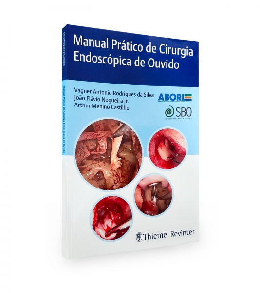 Manual Prático De Cirurgia Endoscópica De Ouvido