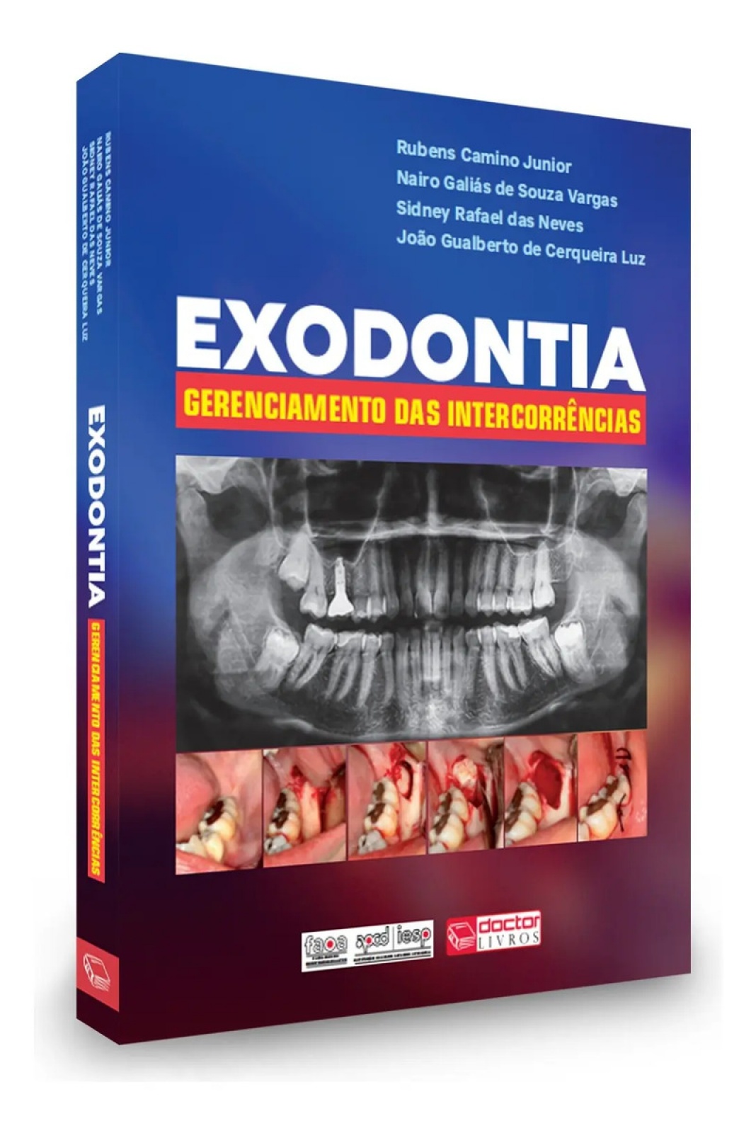 Combo  - Atlas Odontológico Explicativo Para Pacientes + Infecções Odontogênicas E Suas Implicações + Exodontia - Gerenciamento Das Intercorrências 