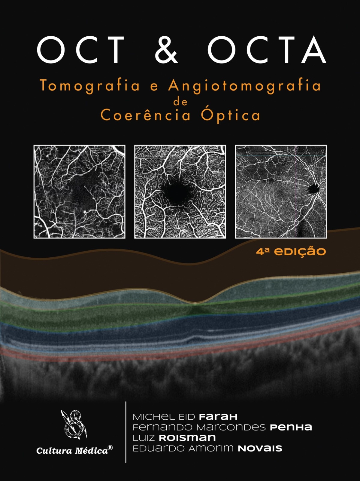 Oct & Octa Tomografia E Angiotomografia De Coerência Óptica