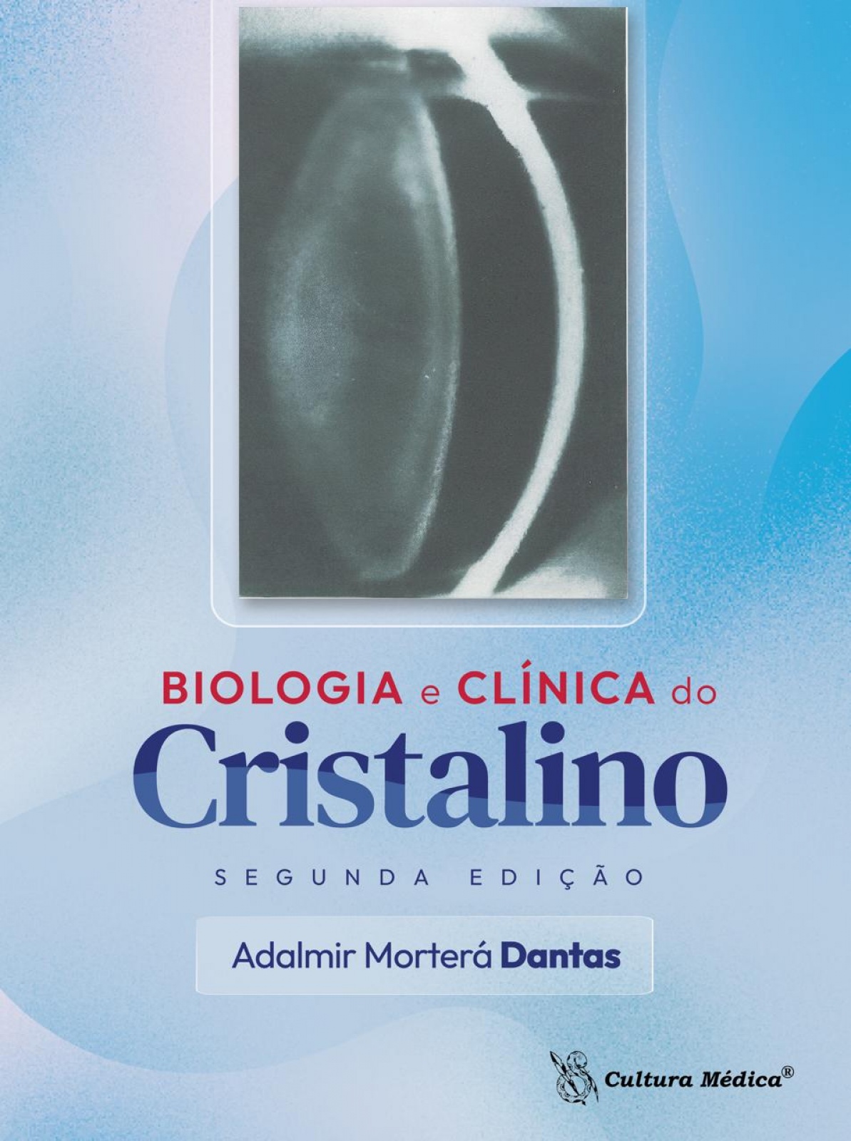 Biologia E Clínica Do Cristalino