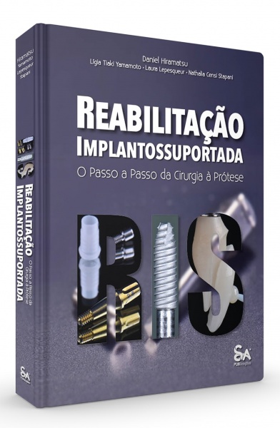 Reabilitação Implantossuportada: O Passo A Passo Da Cirurgia À Prótese