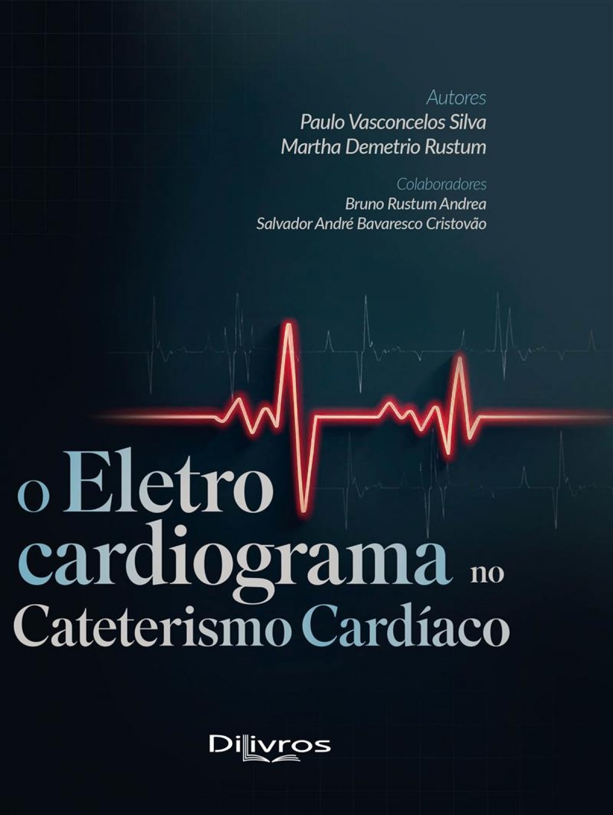 Eletrocardiograma No Cateterismo Cardíaco, O