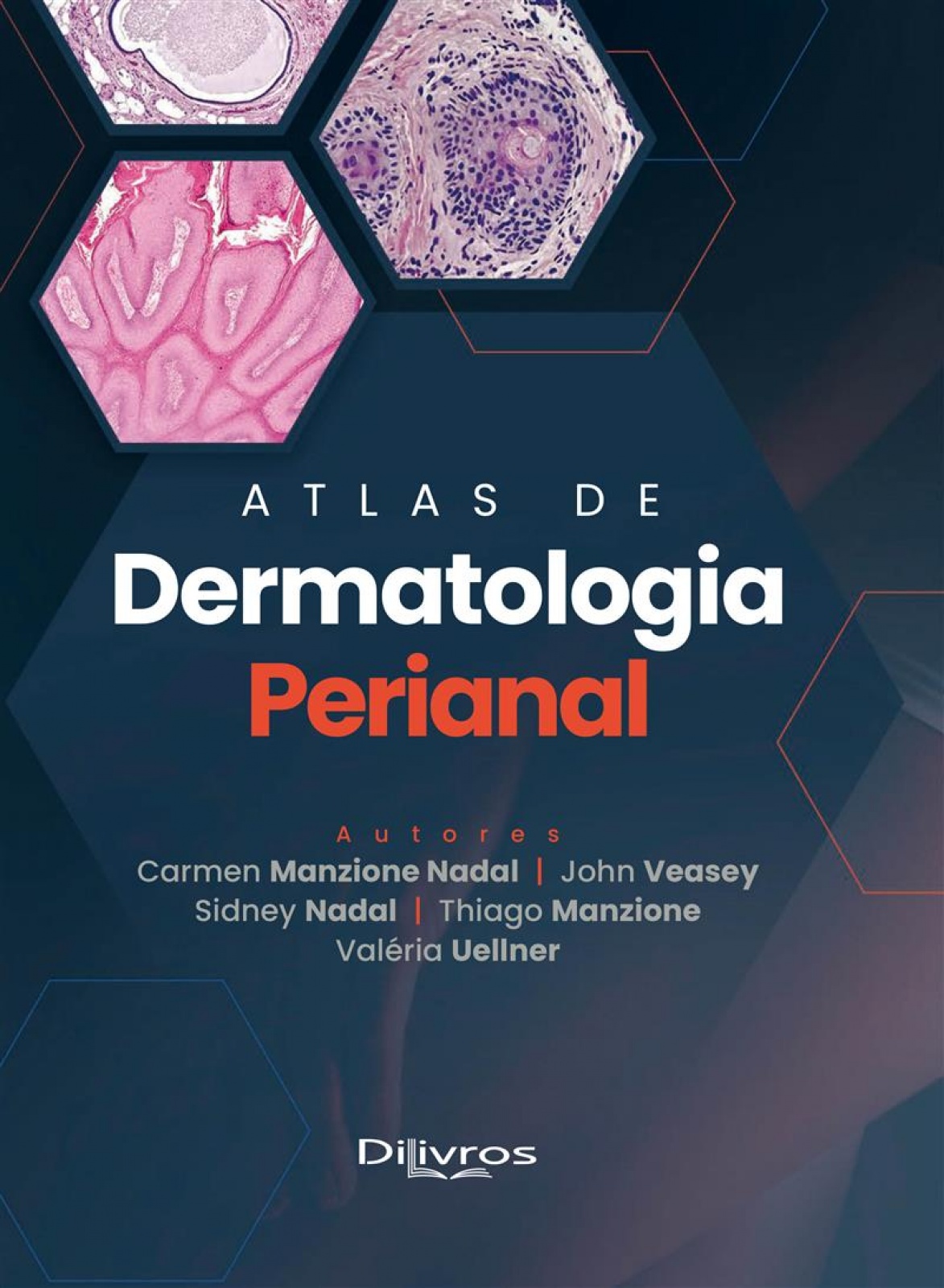 Atlas De Dermatologia Perianal