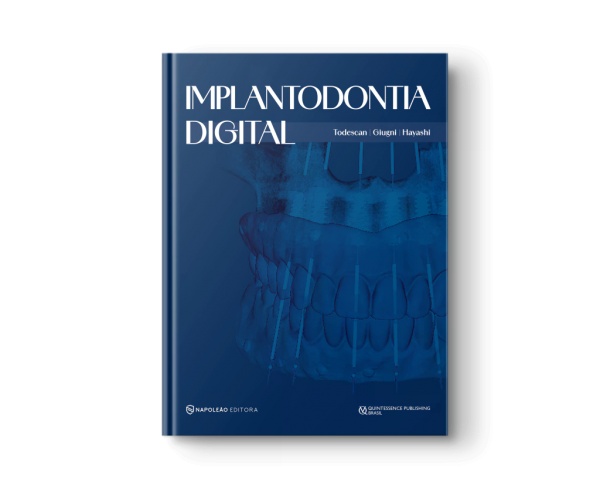 Implantodontia Digital 