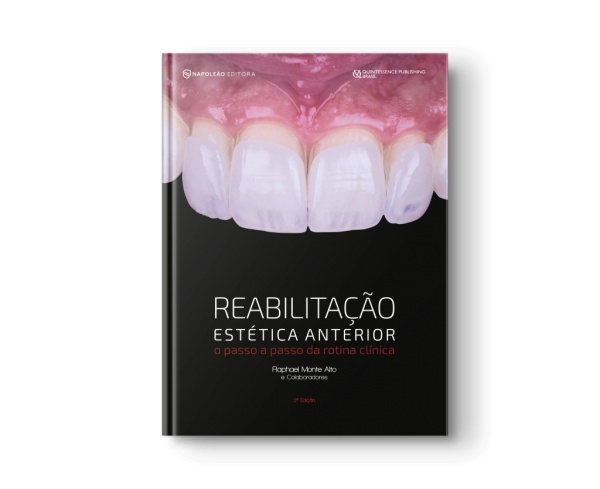 Reabilitação Estética Anterior - O Passo A Passo Da Rotina Clínica 2º Edição