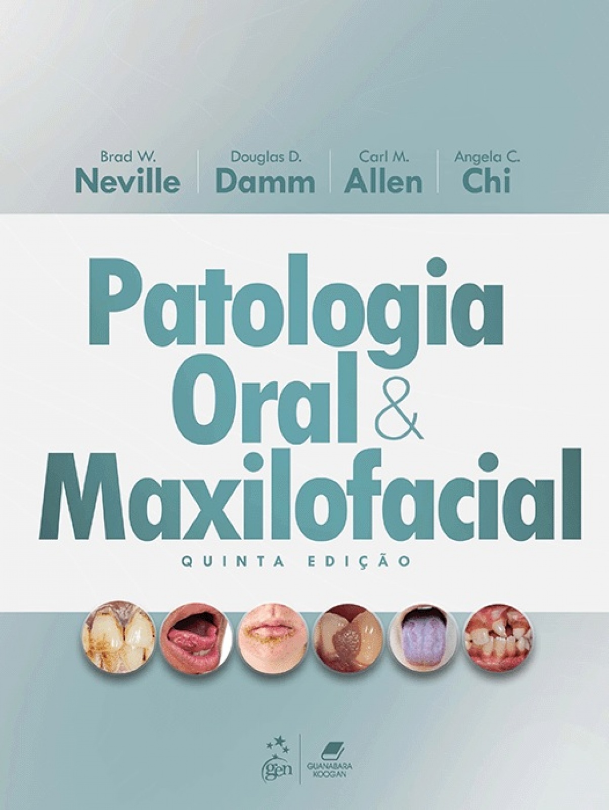 Patologia Oral E Maxilofacial