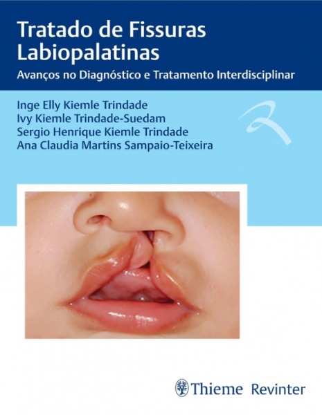 Tratado De Fissuras Labiopalatinas - Avanços No Diagnóstico E Tratamento Interdisciplinar