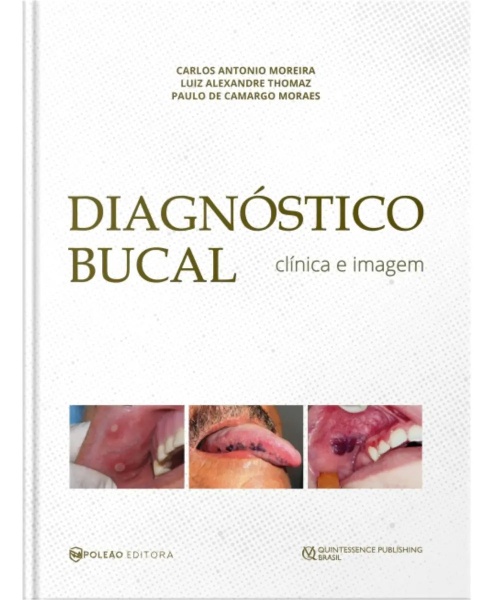 Diagnóstico Bucal Clínica E Imagem