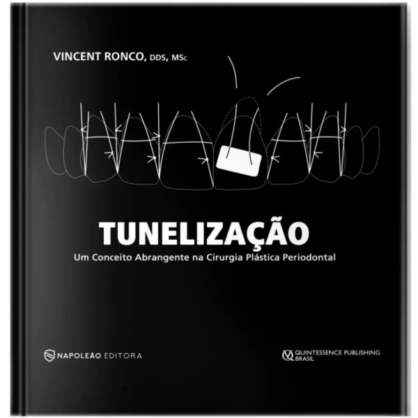 Tunelização Um Conceito Abrangente Em Cirurgia Plástica Periodontal