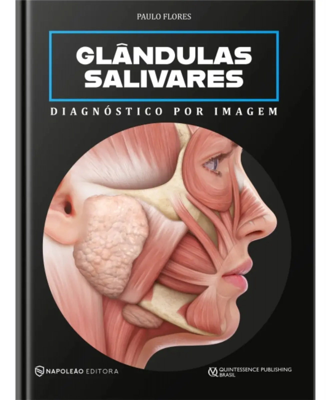 Glândulas Salivares Diagnóstico Por Imagem