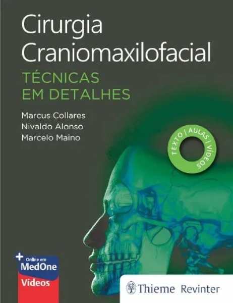 Cirurgia Craniomaxilofacial: Técnicas Em Detalhes