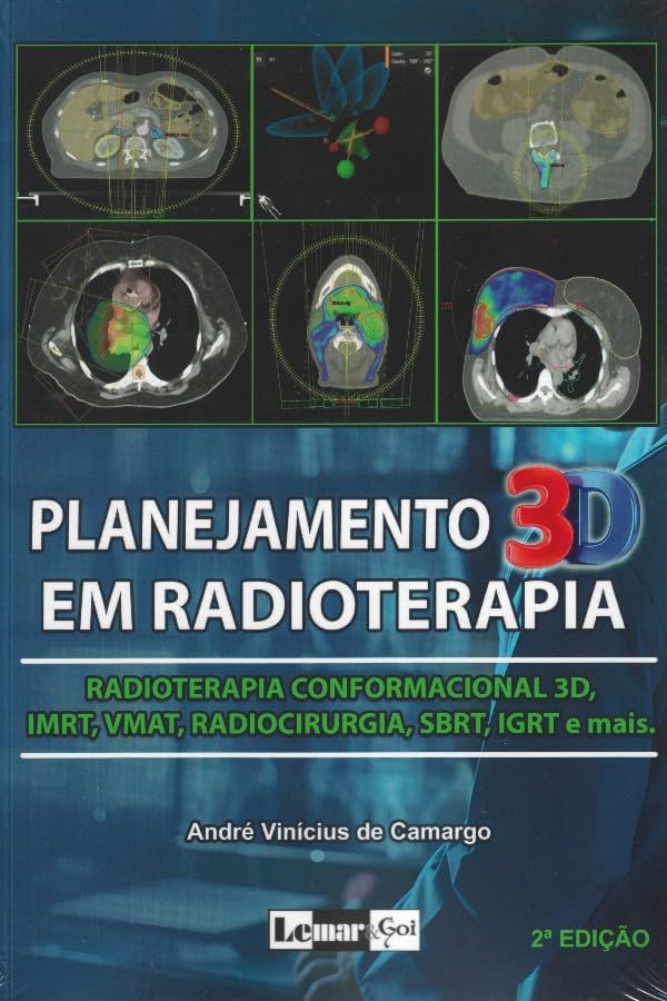 Planejamento 3D Em Radioterapia - Radioterapia Conformacional 3D, Imrt, Vmat, Radiocirurgia, Sbrt, Igrt E Mais