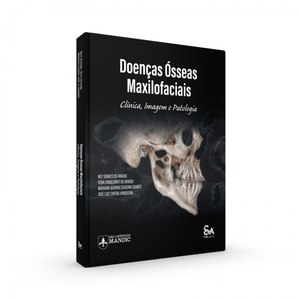 Doenças Ósseas Maxilofaciais Clínica Imagem E Patologia
