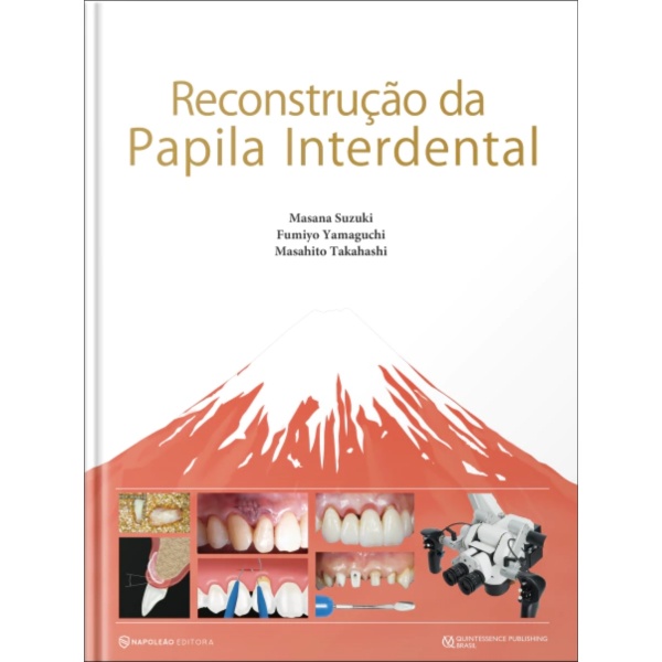 Reconstrução Da Papila Interdental