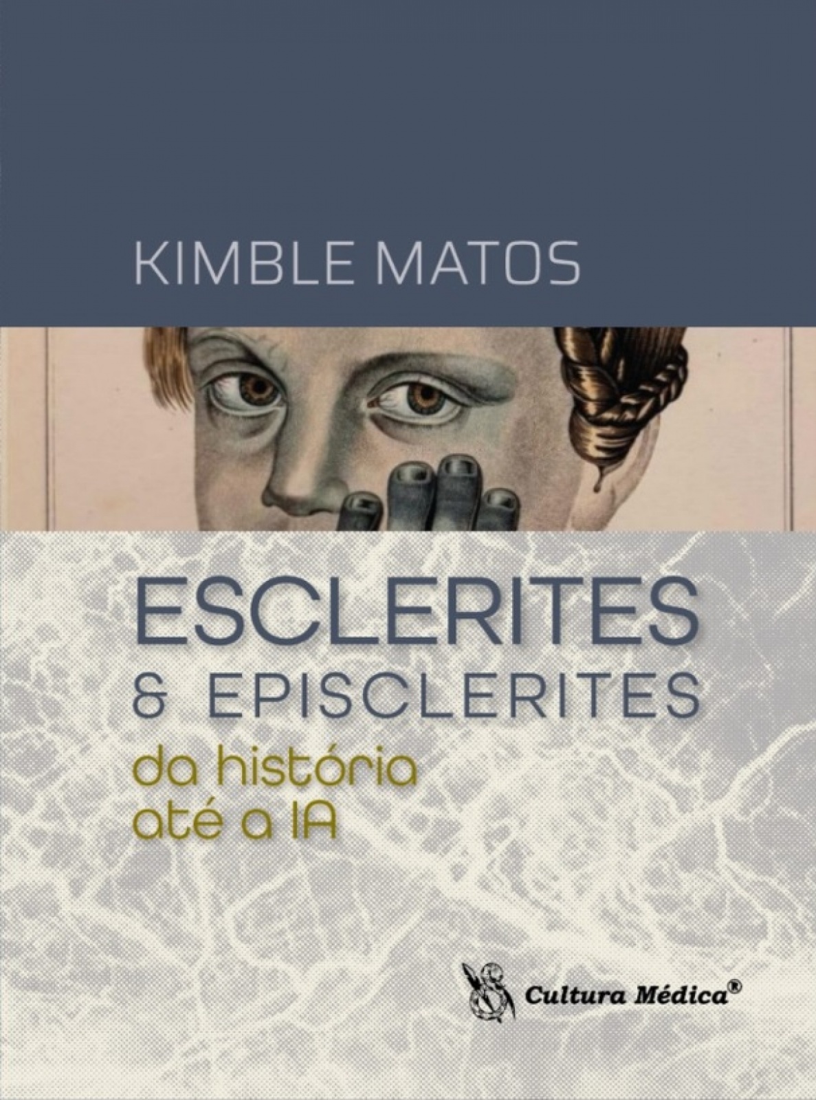 Esclerites & Episclerites – Da História Até A Ia
